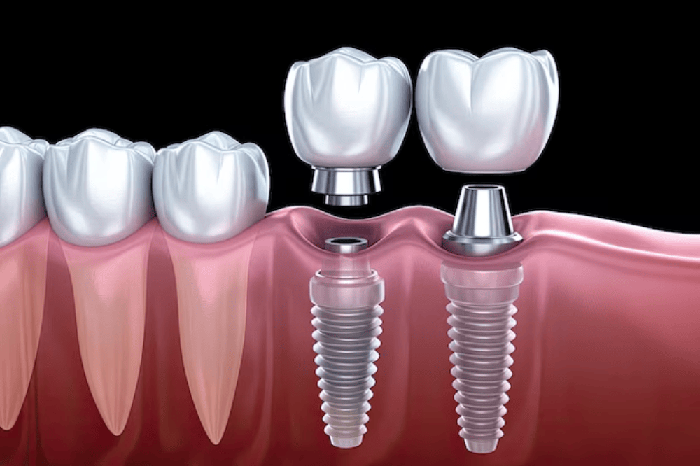 Colina Dental